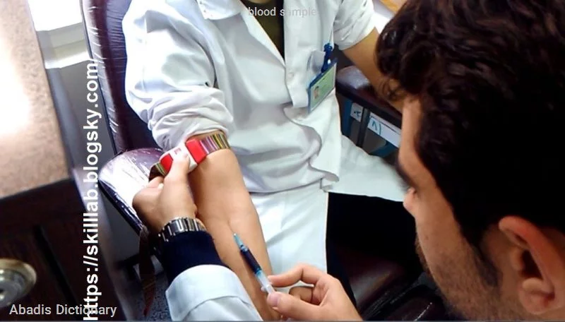 blood sample